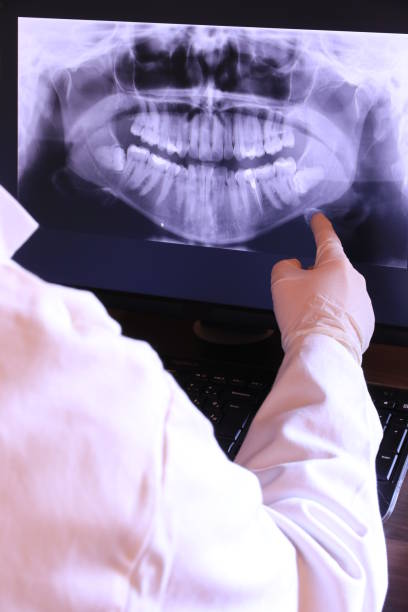 Best Emergency Wisdom Teeth Removal in Glencoe, AL