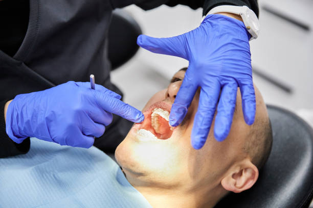 Best Emergency Dental Care for Broken or Chipped Teeth in Glencoe, AL