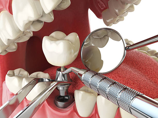 Best Emergency Gum Treatment in Glencoe, AL