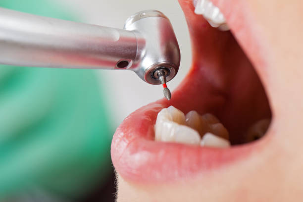 Best Emergency Denture Repair in Glencoe, AL